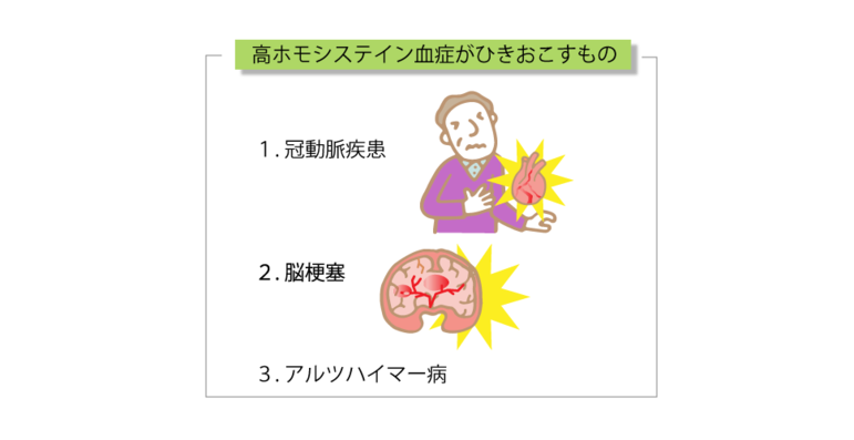 高ホモシステイン血症が引き起こすもの