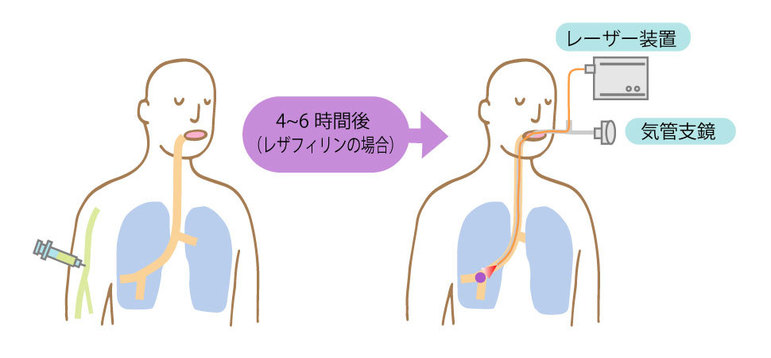 PDTの流れ